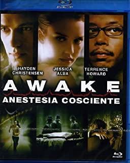 AWAKE- ANESTESIA COSCIENTE